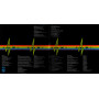 Pink Floyd - The Dark Side Of The Moon (G/f) (LP)